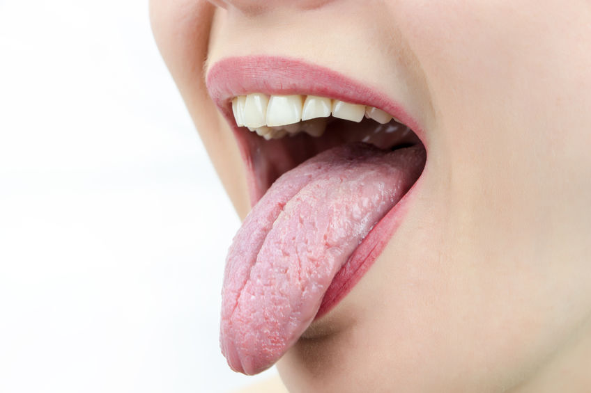 remédier à la langue blanche (saburrale) due au stress